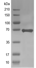 Western blot of AQR1 recombinant protein