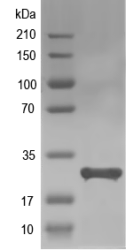 Western blot of CSH2 recombinant protein