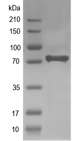 Western blot of CYLC1 recombinant protein