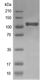 Western blot of Cd101 recombinant protein