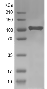 Western blot of ENPEP recombinant protein