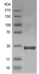 Western blot of HLA-DRB1 recombinant protein