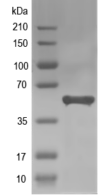 Western blot of HNRNPK recombinant protein