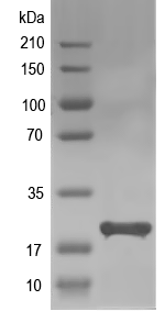 Western blot of IFNAD recombinant protein