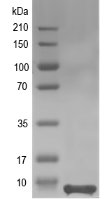 Western blot of ORF75 recombinant protein