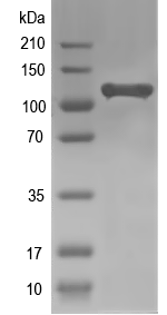 Western blot of POTEI recombinant protein