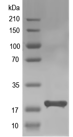 Western blot of PP_5201 recombinant protein