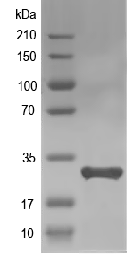 Western blot of TSPAN1 recombinant protein