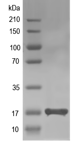 Western blot of acu-17 recombinant protein