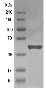 Western blot of ccna2 recombinant protein