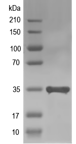 Western blot of hasP recombinant protein