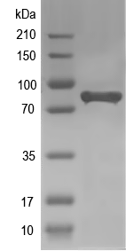 Western blot of helA recombinant protein