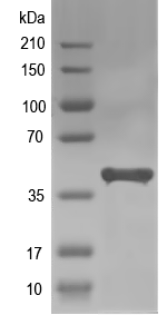 Western blot of hemA recombinant protein