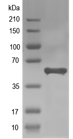 Western blot of hemA recombinant protein