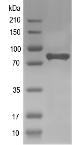 Western blot of katG recombinant protein