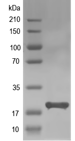 Western blot of lec-7 recombinant protein