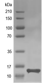 Western blot of rplN recombinant protein