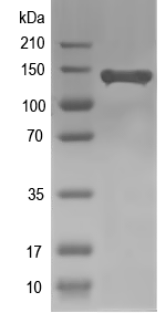 Western blot of rpoC2 recombinant protein