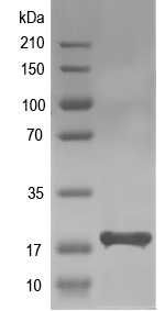 Western blot of ssbA recombinant protein