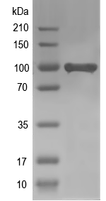 Western blot of tcaf recombinant protein