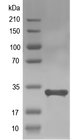 Western blot of AAEL013712 recombinant protein