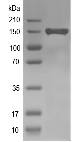 Western blot of ABA-1 recombinant protein