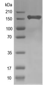 Western blot of ABCC5 recombinant protein