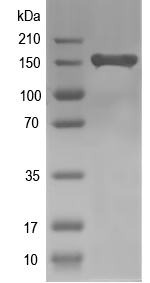 Western blot of ABCC5 recombinant protein
