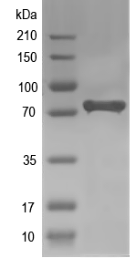 Western blot of ABCG8 recombinant protein