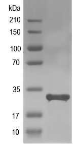 Western blot of ABSDF2152 recombinant protein