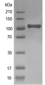 Western blot of ACA11 recombinant protein