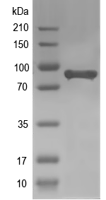 Western blot of ACAP2 recombinant protein