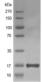 Western blot of ACIAD1132 recombinant protein