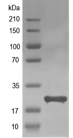 Western blot of ACL_0869 recombinant protein