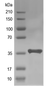 Western blot of ACL_1123 recombinant protein