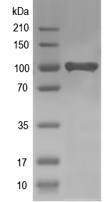 Western blot of ACTN3 recombinant protein