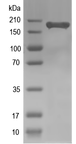 Western blot of ADCY10 recombinant protein