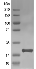 Western blot of ADI1 recombinant protein