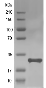 Western blot of AF_0310 recombinant protein