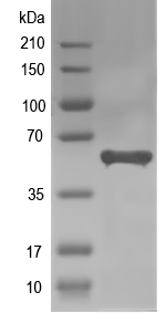 Western blot of AGD5 recombinant protein