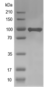 Western blot of AGO17 recombinant protein