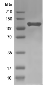 Western blot of AGO3 recombinant protein