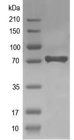 Western blot of AGPS recombinant protein