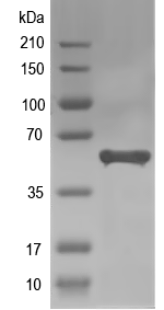 Western blot of AGPS1 recombinant protein