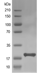 Western blot of AGR2 recombinant protein