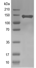 Western blot of AGRN recombinant protein