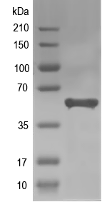 Western blot of AGT recombinant protein