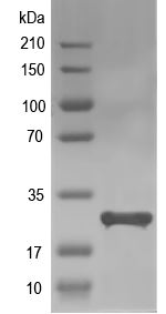 Western blot of AHA_0160 recombinant protein