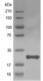 Western blot of AHA_2872 recombinant protein