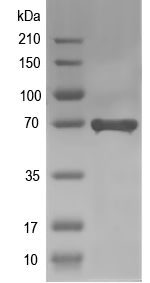 Western blot of AHCYL2 recombinant protein